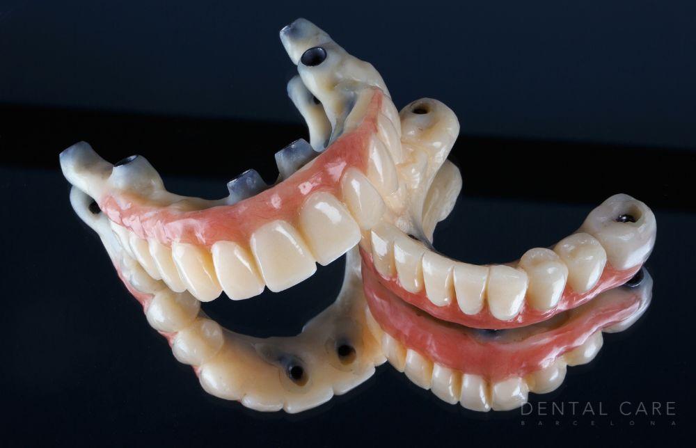 Últimas novedades en implantología dental: técnicas, materiales y resultados