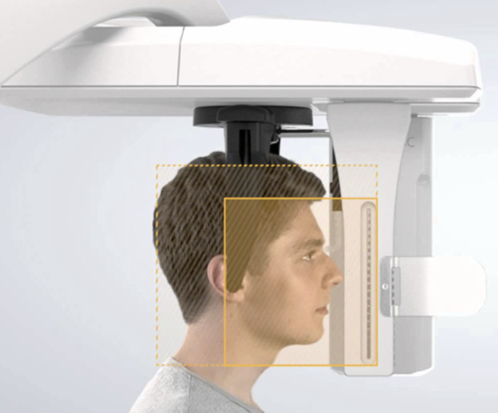 escaner tridimensional maxilofacial
