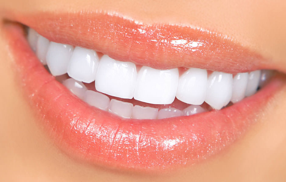 ¿Por qué invertir en tu sonrisa es la mejor decisión para tu salud y confianza?