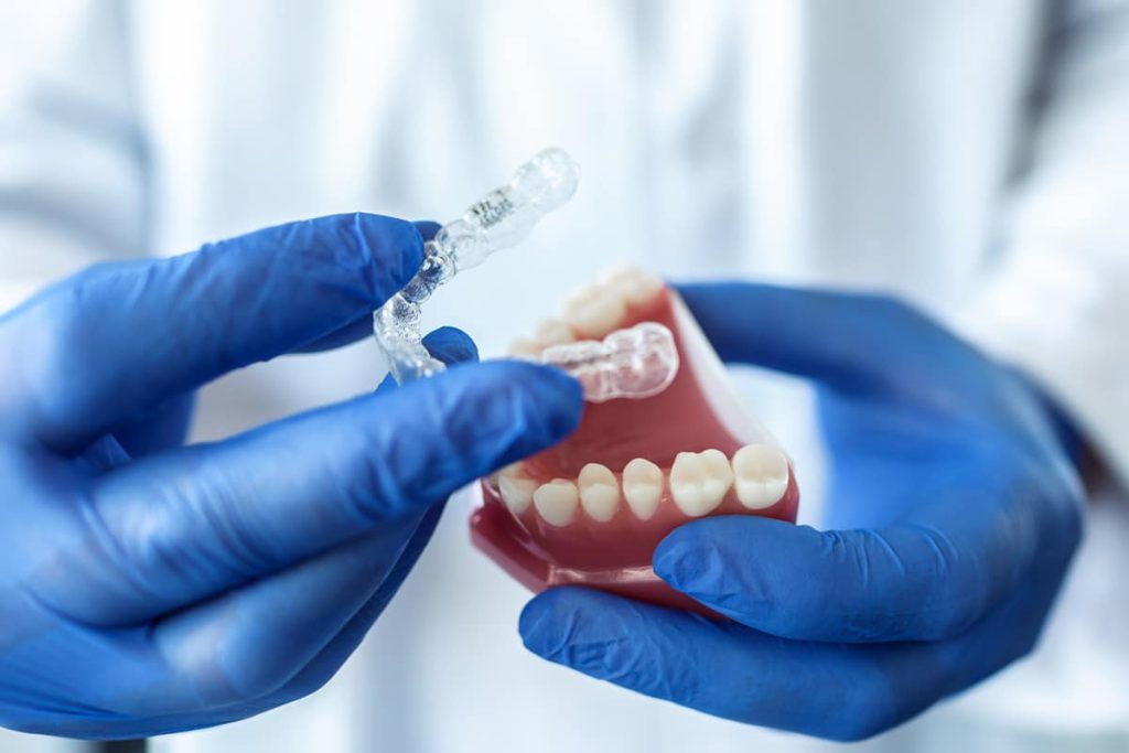Férulas Dentales: Qué son y beneficios para tu Salud Bucal