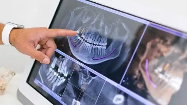 radiografía 3d dental